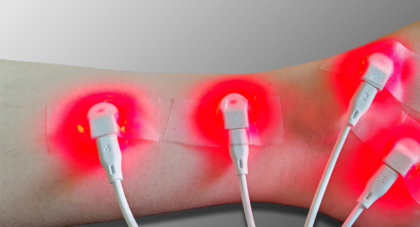 Praticien utilisant plusieurs dispositifs miniRed sur une cheville pour une séance complète d’acupuncture LED rouge.